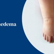 What is LYMPHEDEMA?